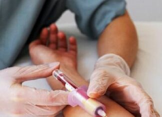 Jura. Bientôt une simple prise de sang pour détecter un cancer du poumon ?