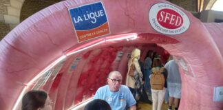 un côlon géant a fait halte à Dole