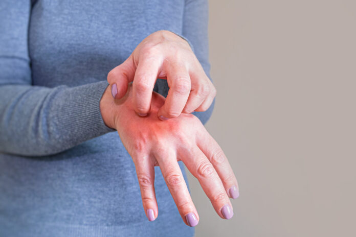 istockphoto